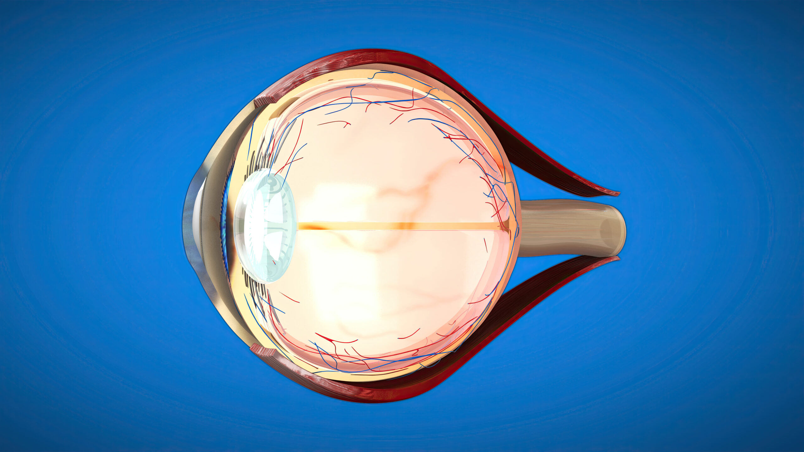 Glaucoma surgery in mumbai