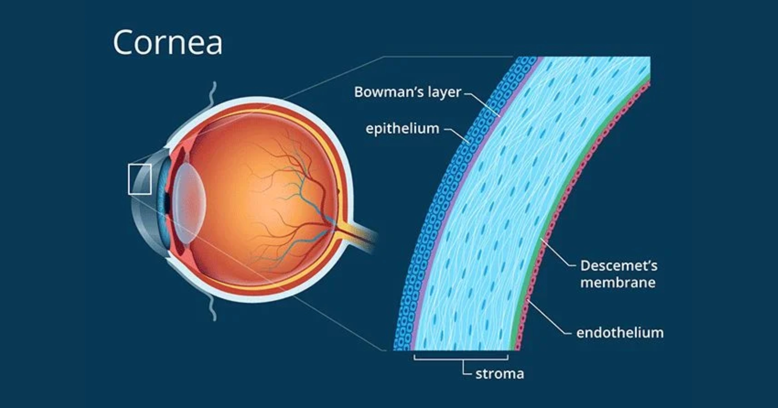 Cornea surgery in mumbai