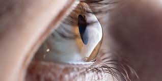 Keratoconus Treatment In Mumbai